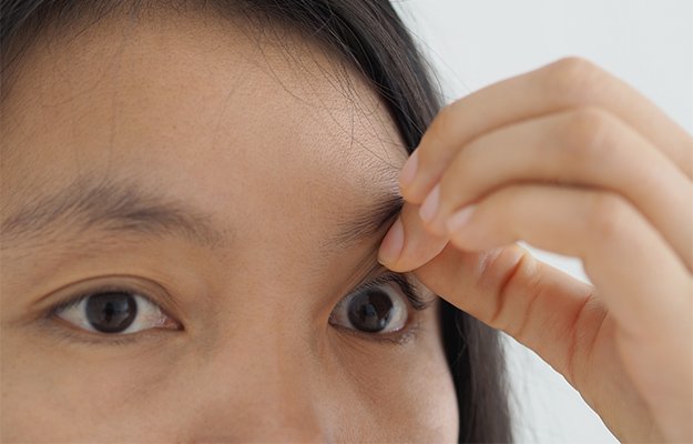 macular-pucker-and-retinal-detachment-in-woman-Symptoms-as-body
