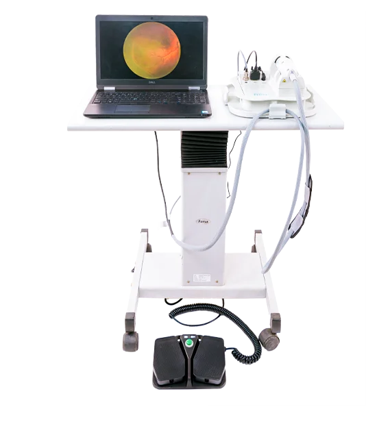 Forus Health digital retinal cameras