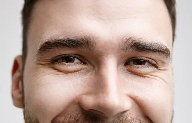 How to Treat a Swollen Eye