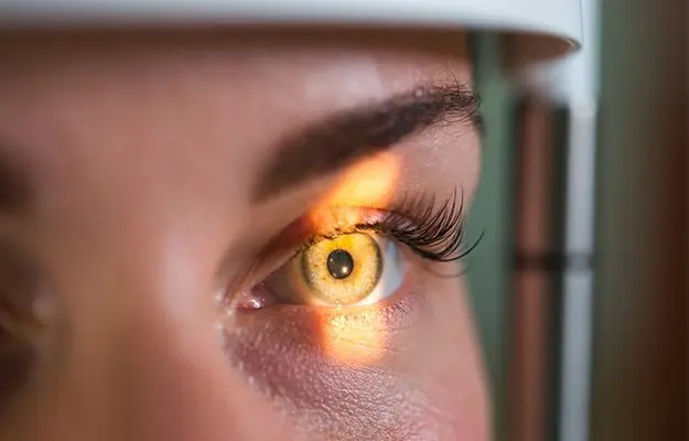 What Are Vitreous Floaters?