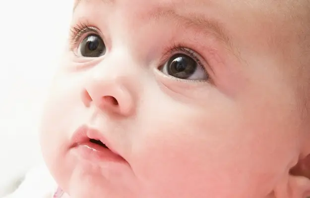 Congenital Glaucoma