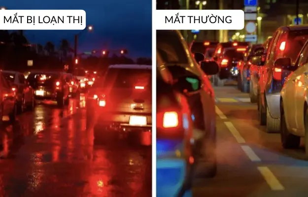 dấu hiệu loạn thị